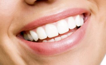 white-teeth-925x425-1