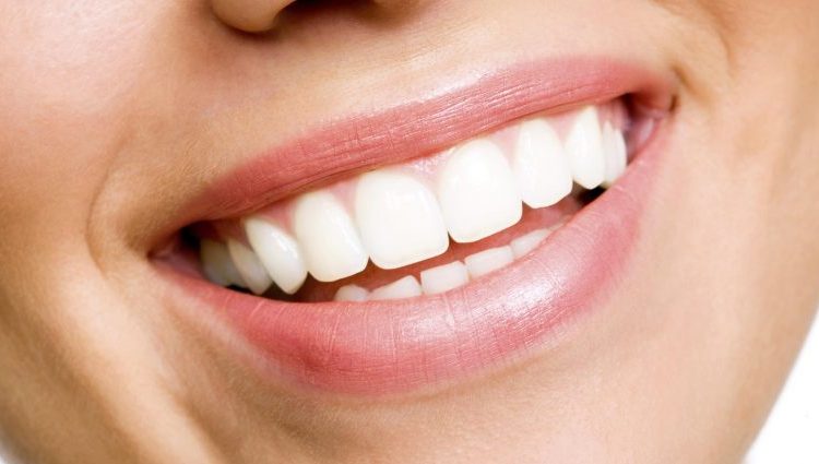 white-teeth-925x425-1