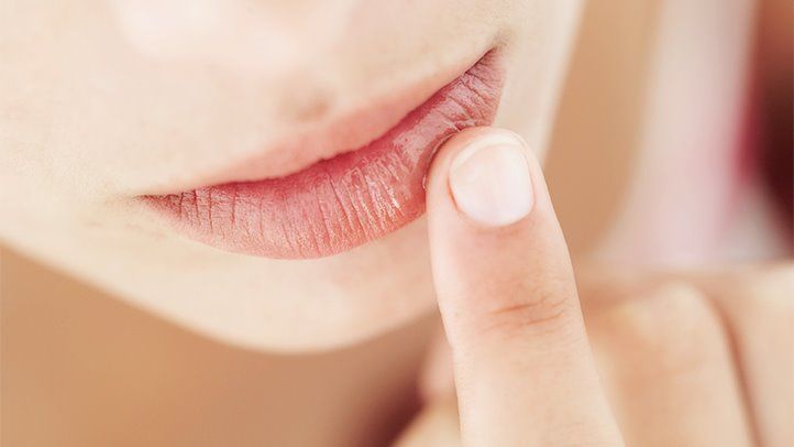 home-remedies-for-chapped-lips-722x406