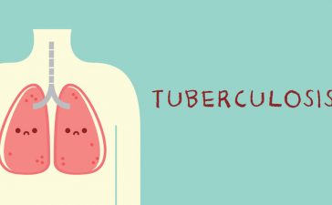 Kementerian Kesehatan (Kemenkes) berencana melakukan skrining penyakit tuberculosis (TBC) secara besar-besaran di Indonesia.