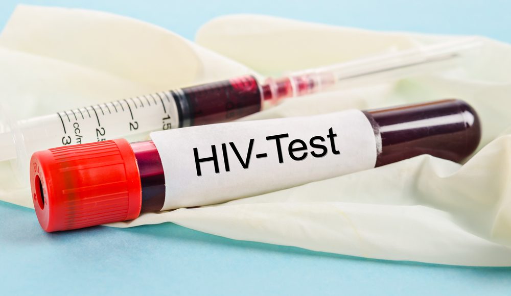hiv test. Dok/Shutterstock