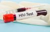 hiv test. Dok/Shutterstock