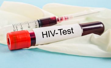 hiv test. Dok/Shutterstock