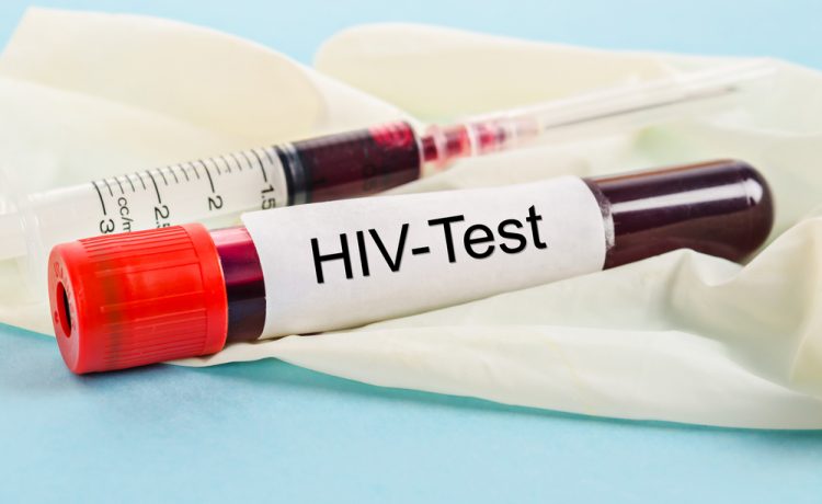 hiv test. Dok/Shutterstock